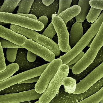 Colorised electron micrograph showing E coli bacetria as green tubular strucutres.