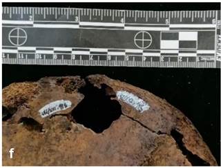 Investigating bone damage and tumour tactics using neutron spectrometry 