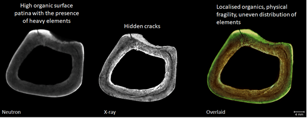 Three roughly circular cross-sections through a bone showing the presence of organic material (1st image), hidden cracks (second image), and a composite image showing both features